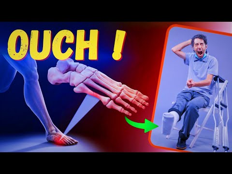 BROKEN BONES? How does the body repair a bone or stress fractures? [Video]