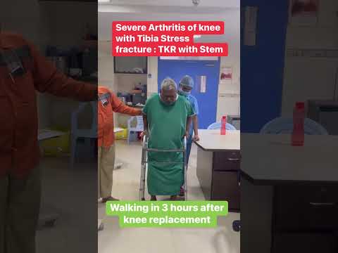 Fast Track Knee Replacement [Video]