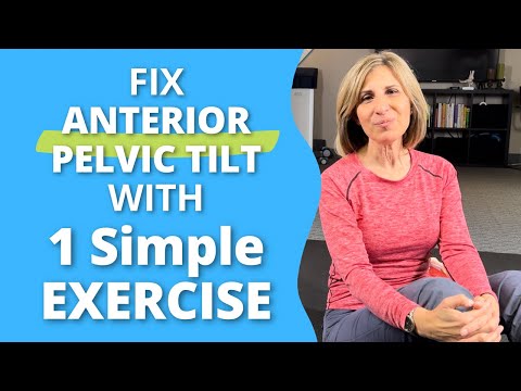 Fix Anterior Pelvic Tilt with 1 Simple Exercise [Video]