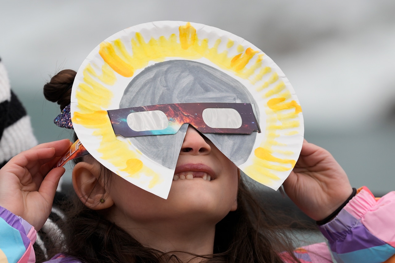 Did you look at the sun during the eclipse? What to do about sore eyes [Video]