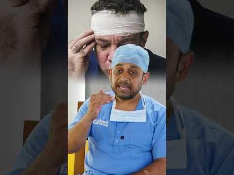 Understanding the ABC of Head Injury and Types | Expert Insights by Dr. Prabhu Short 8 [Video]