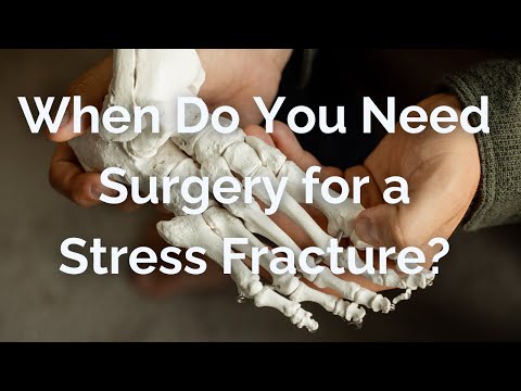 When Do You Need Surgery for a Stress Fracture? [Video]