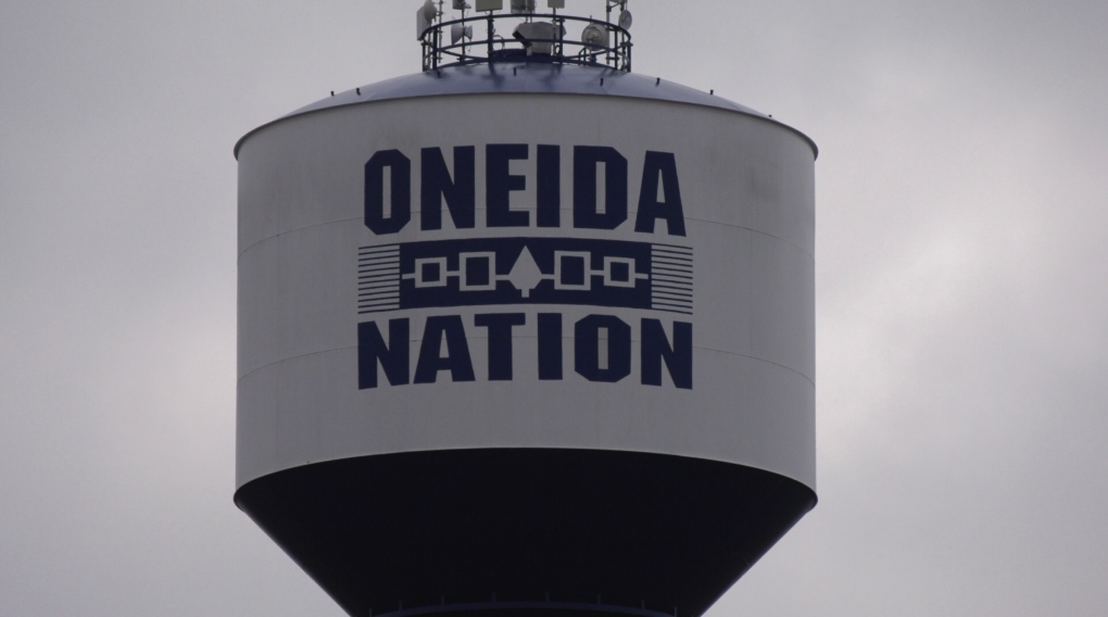 Person injured in dog attack in Oneida [Video]