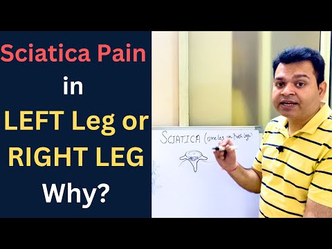 Sciatica, Pain in One leg or Both Legs, Disc Bulge, Lumbar canal Stenosis,  Nerve Compression in Leg [Video]
