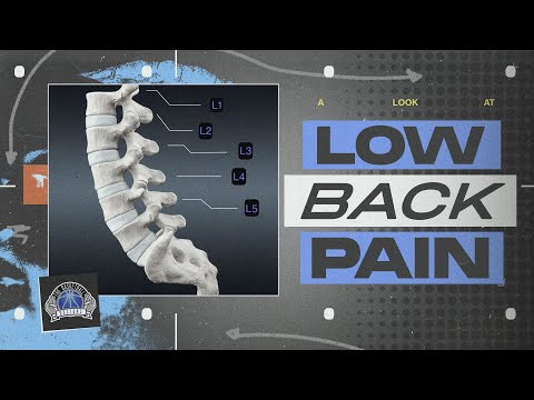 Low Back Pain: Joint Irritation [Video]
