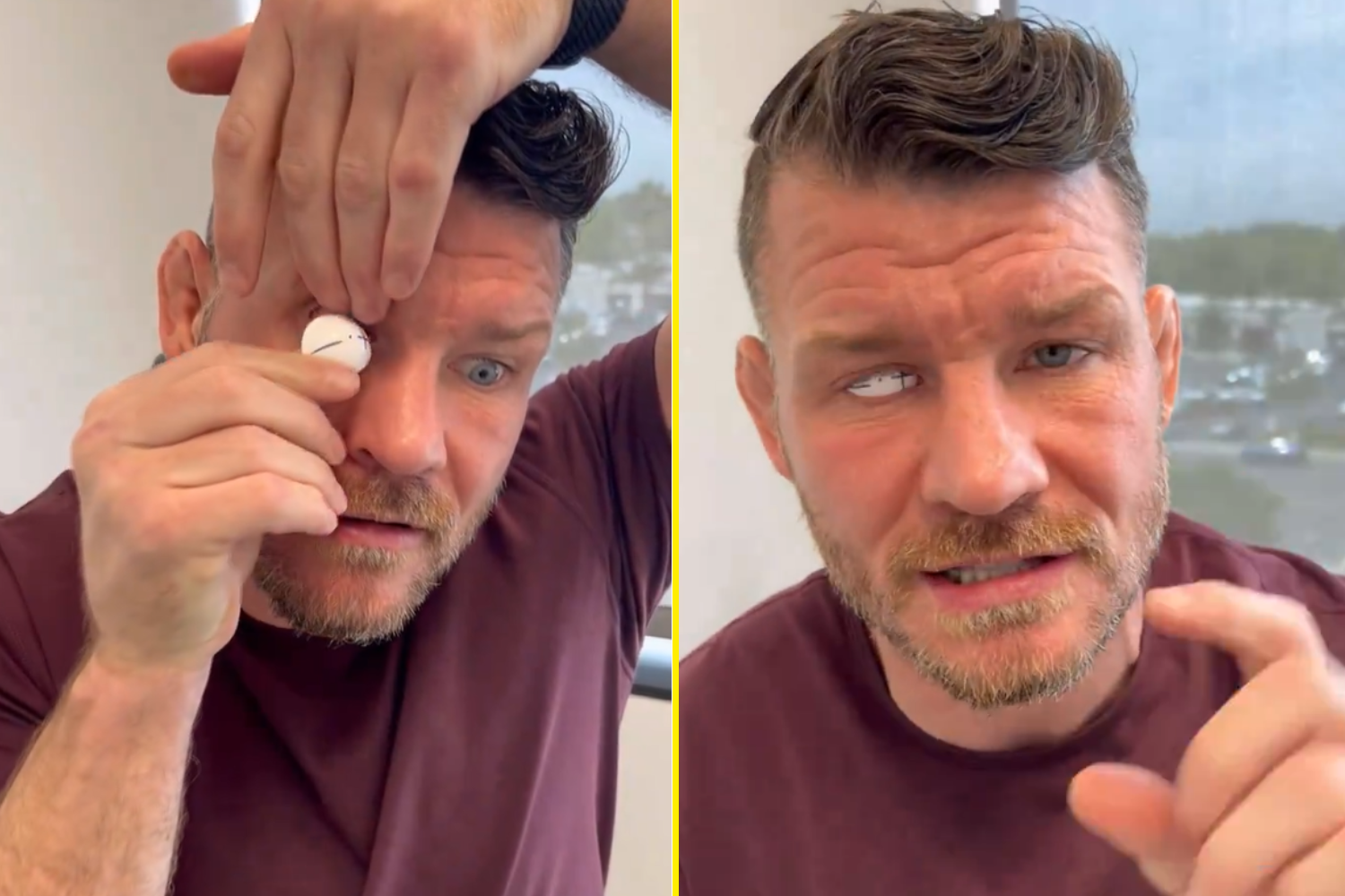 You cant even tell – UFC legend Michael Bisping sees the funny side as he tries out new prosthetic eye before its ready [Video]