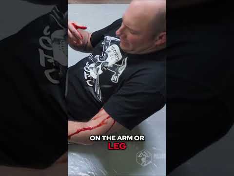 First Aid Basics: How to Stop Bleeding  [Video]