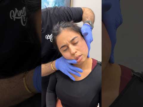 Part 3: She could barely open her mouth 😬 *HUGE CRACKS* *TMJ treatment* [Video]
