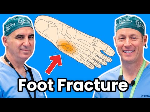 How To Treat Your Broken Foot. Jones and Fifth Metatarsal Fractures [Video]