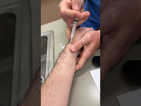 Injection in wrist after fracture and tendon injury. [Video]