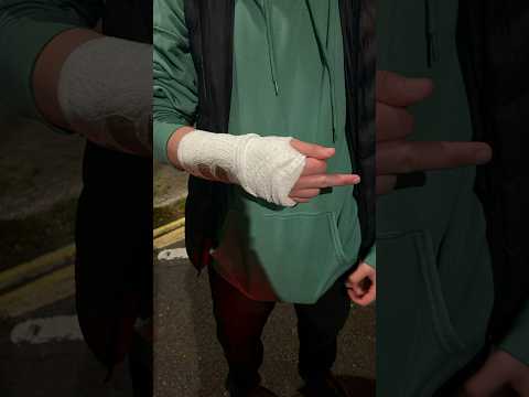 He fractured his wrist doing this…😱 [Video]