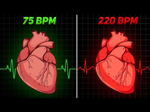 Find out Why This Patient’s Heart Rate Increased? :Case Discussion [Video]