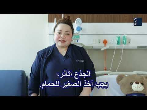 How to Treat Minor Burns at Home | King’s College Hospital Dubai – Pediatric Clinic [Video]
