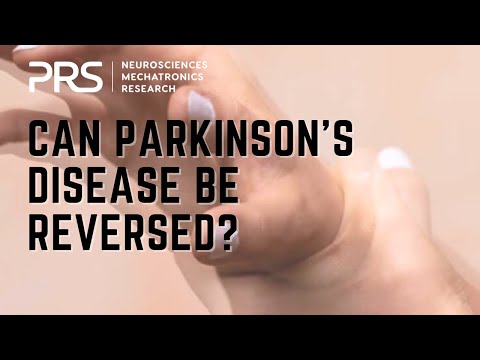 Can Parkinson’s Disease be reversed? | Answering Parkinson’s FAQ’s | Ep. 07 | [Video]
