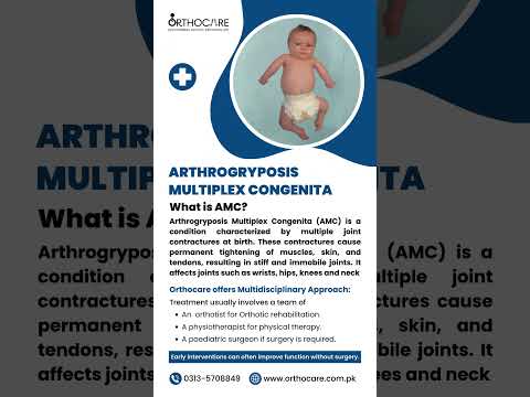 Arthrogryposis Multiplex Congenita #Arthrogryposis #Multiplex  [Video]