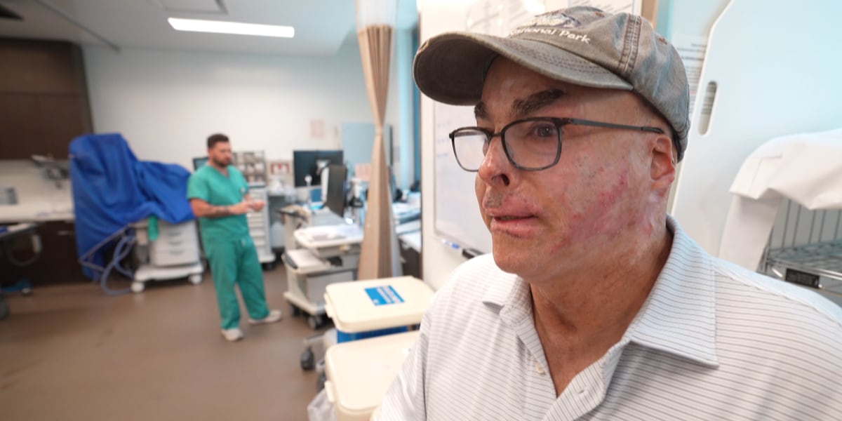FIRE TO SURVIVE: Plane crash survivor inspires others thanks to life saving burn care at New Orleans hospital [Video]