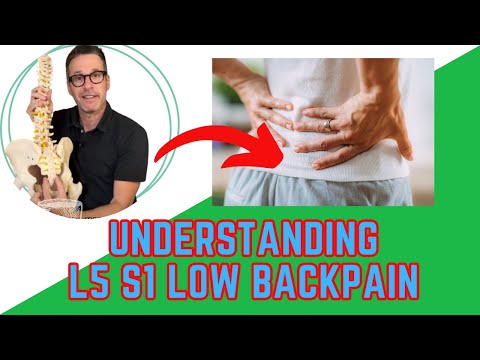 Understanding L5 S1 Low Back Pain: Causes, Symptoms & Treatment | Expert Insights [Video]