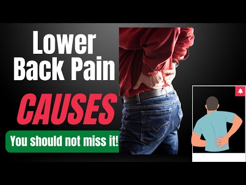 Low Back Pain Causes {and 7 Worrying Signs} [Video]