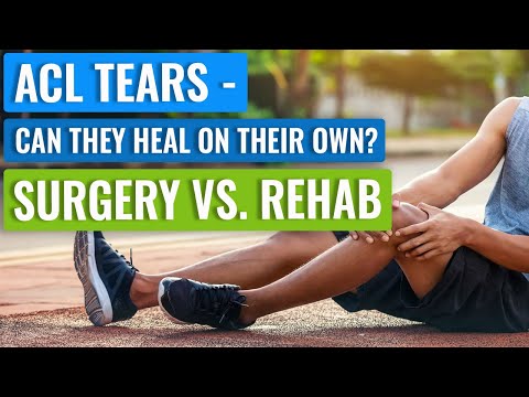 ACL Surgery – Who Needs It vs. Not? Can ACL Injuries Heal On Their Own? [Video]