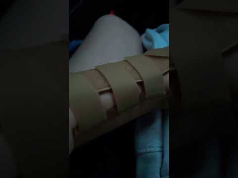 My Friend Lexi sprained her wrist ￼ [Video]