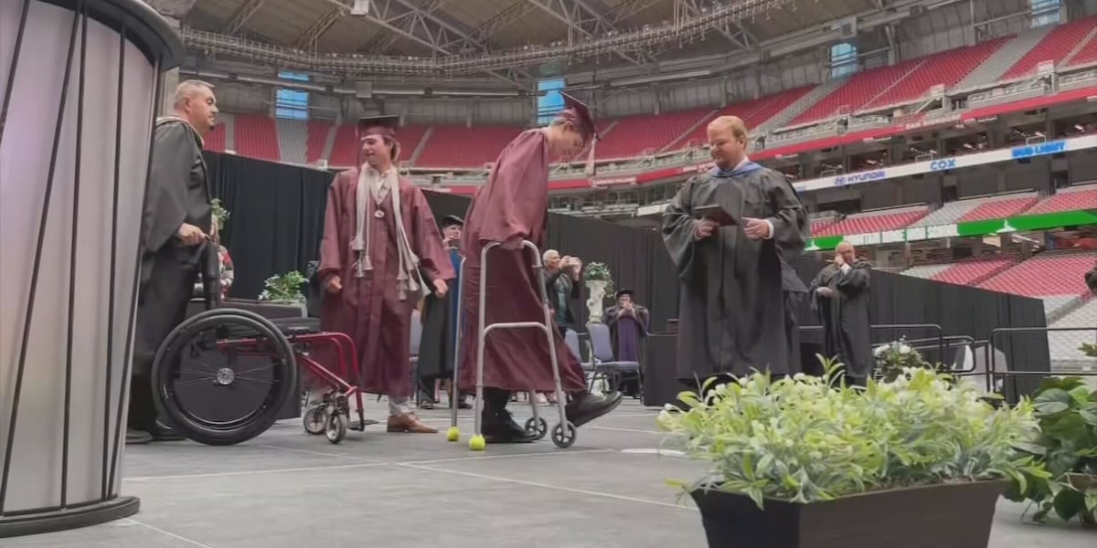 Glendale graduate walks across stage months after leg amputation [Video]