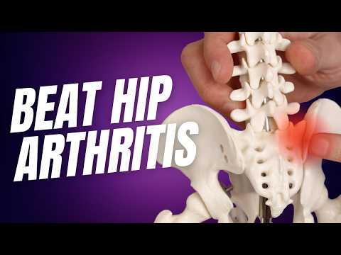 Why People Fail to Heal Hip Osteoarthritis [Video]