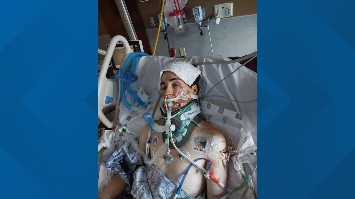 Texas tornado survivor speaks from hospital bed [Video]
