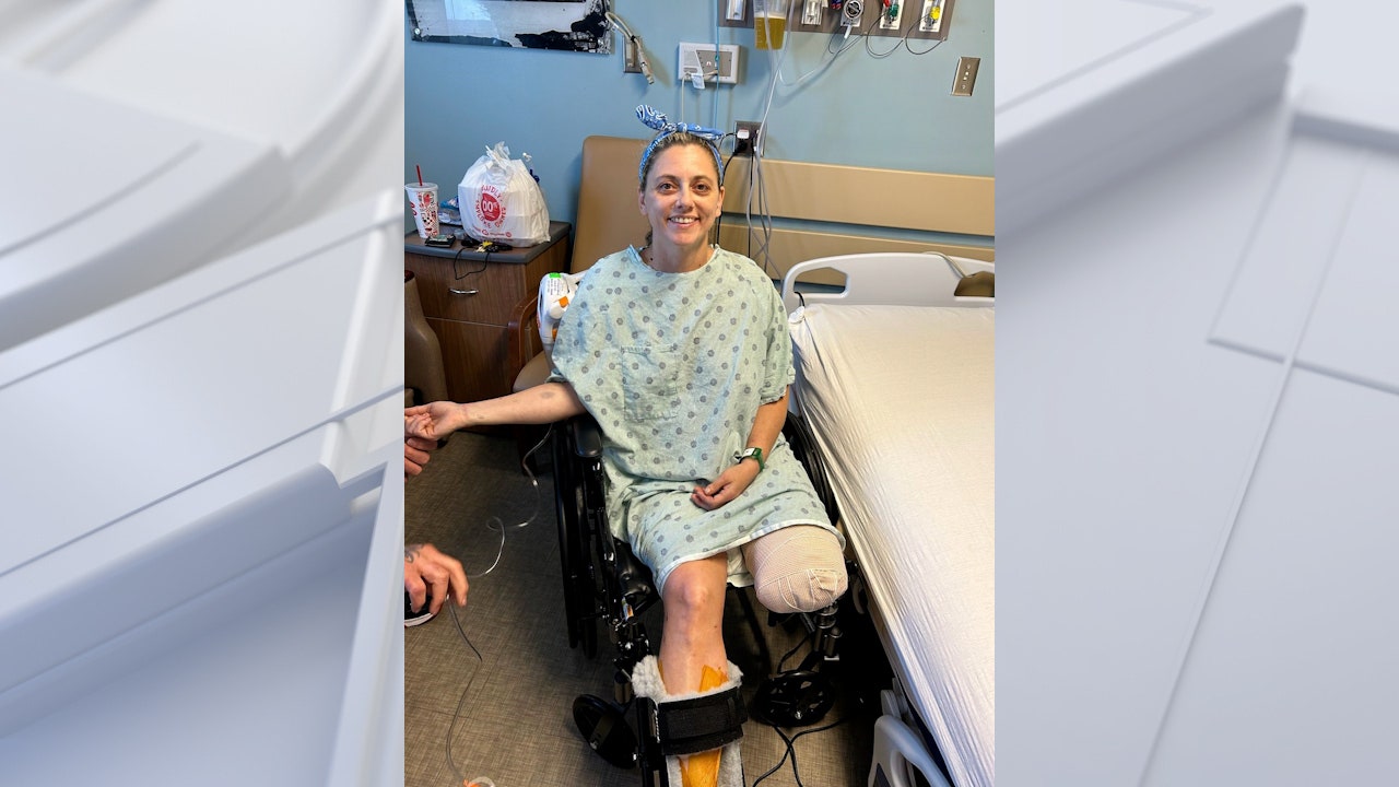 Alabama woman loses leg in boating accident, remains positive: ‘I’ve got to make the best of it’ [Video]