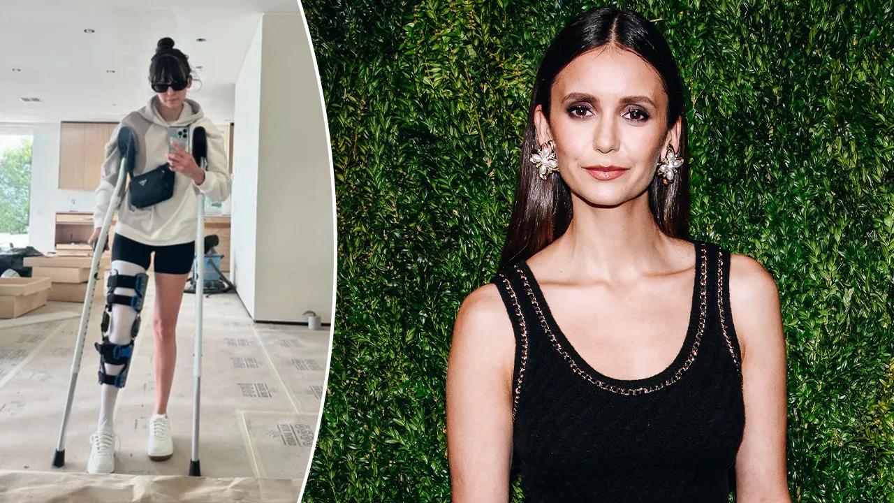 Nina Dobrev says ‘life looks a lil different’ since being hospitalized after bike accident [Video]