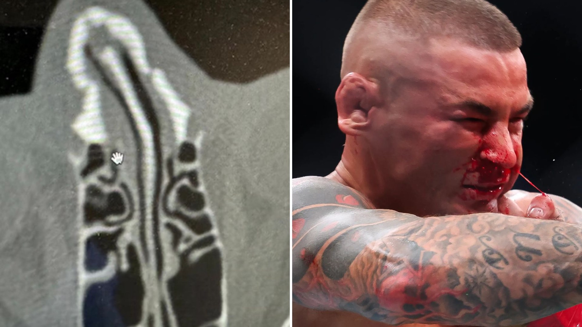 UFC star hit with INDEFINITE ban following three horror injuries as career hangs by thread after Makhachev loss [Video]