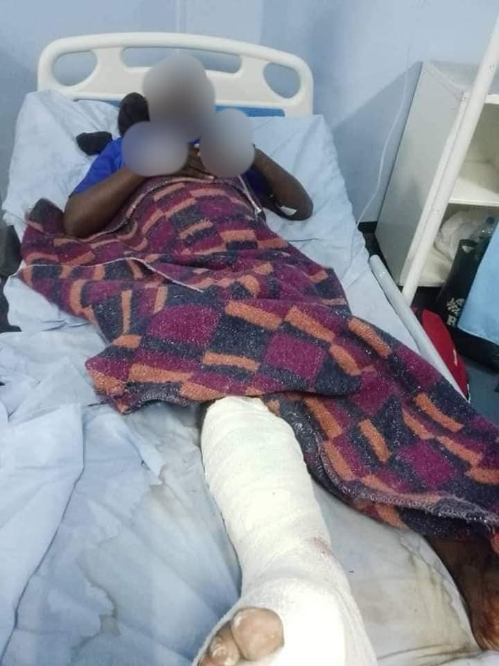 Fan Injured During Chipolopolo Match In Zambia [Video]
