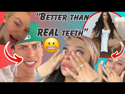 Reality Star’s VENEERS Disaster! Dental Surgery Gone WRONG! 😬 [Video]