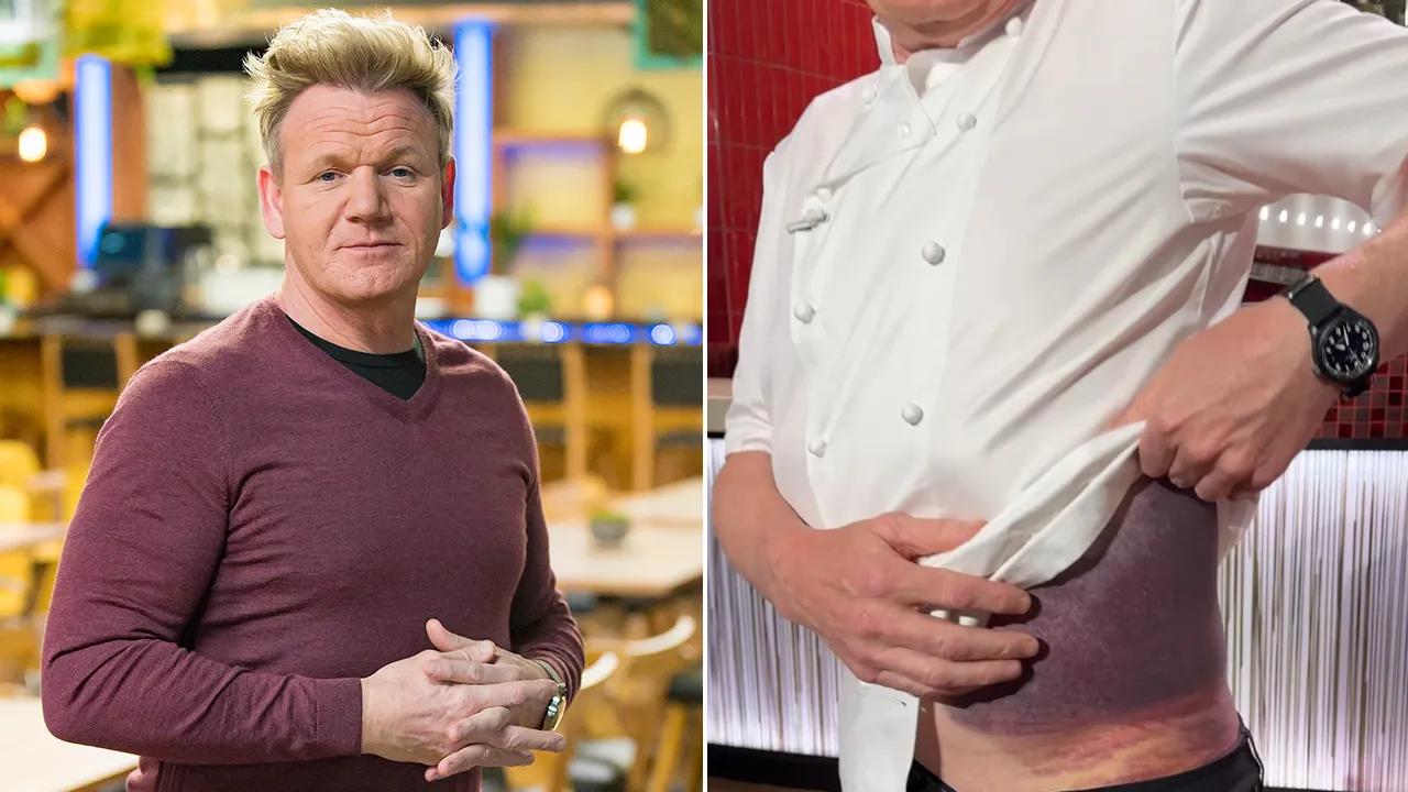 Gordon Ramsay ‘lucky’ to be alive following serious bicycle accident [Video]
