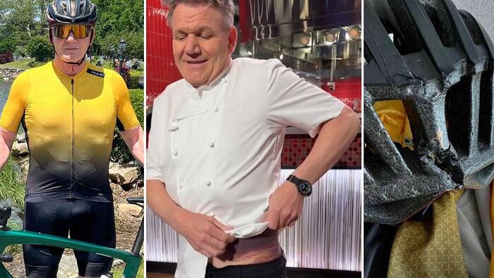 Watch: Badly Wounded Gordon Ramsay Shows Off Massive Bruise, Says Bike Helmet Saved His Life [Video]