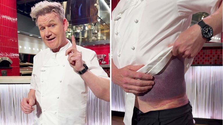 Gordon Ramsay Lucky to be Alive After Bad Bicycle Accident [Video]