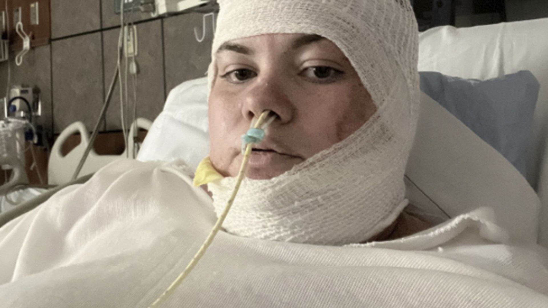 I woke up from coma PREGNANT after chicken fryer accident melted half my skin – docs said to prepare for our funerals [Video]
