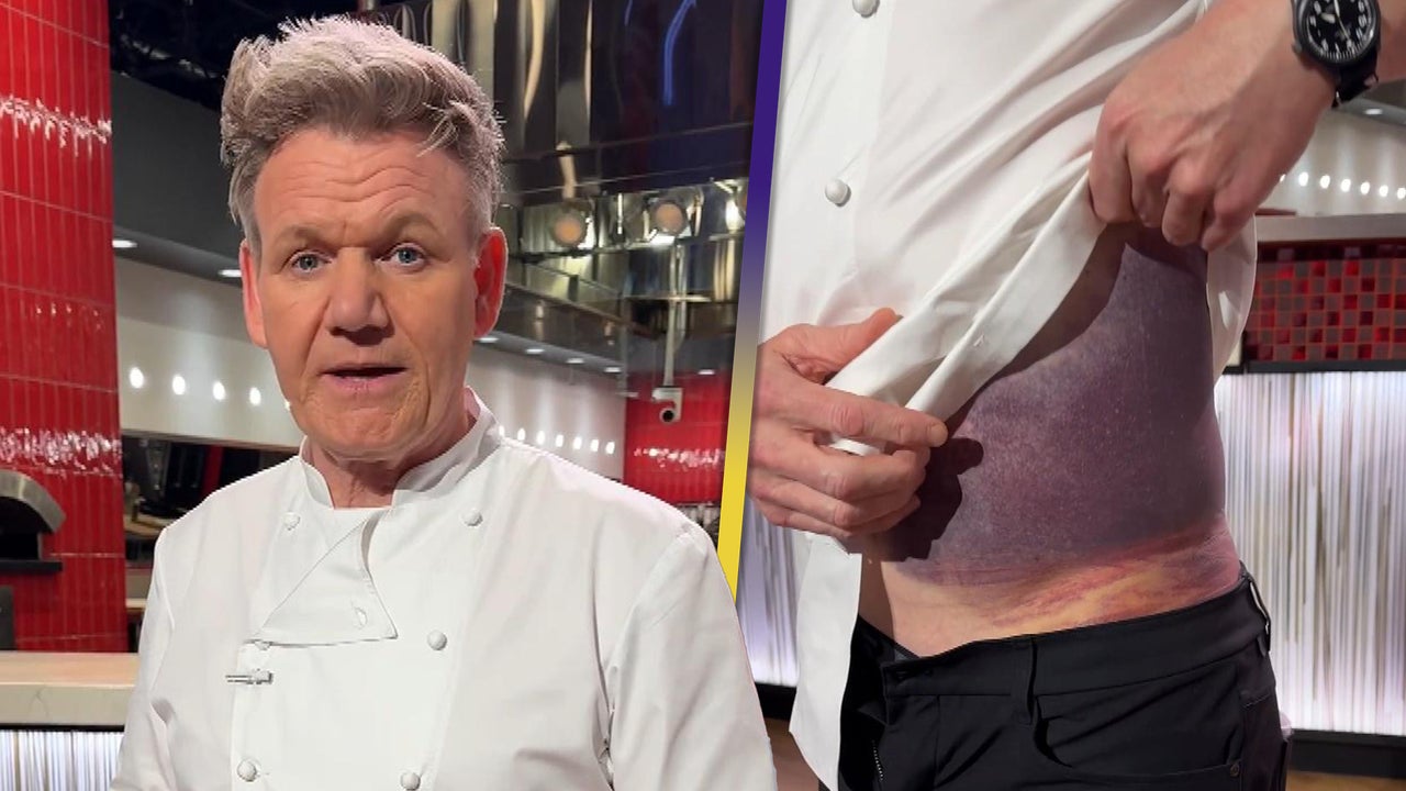 Gordon Ramsay ‘Lucky to Be Standing Here’ After Bike Crash Leaves Him Badly Bruised [Video]