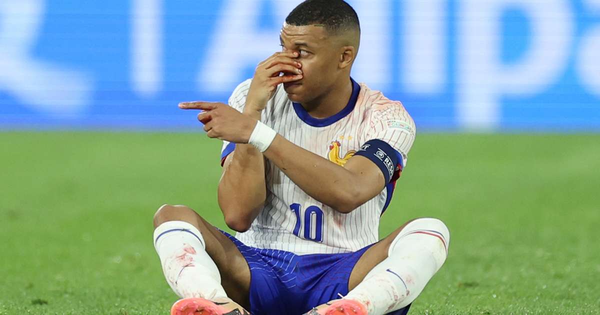 Mbappe avoids surgery after breaking nose in Austria win [Video]