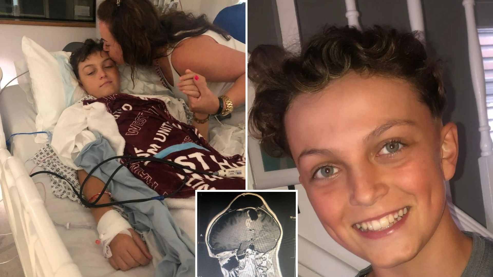 My teenage sons GP told him to stop using his phone so much – months later he was diagnosed with a brain tumour [Video]