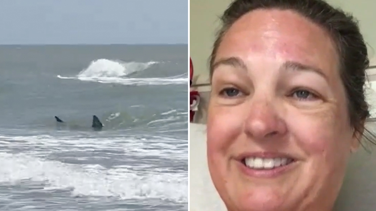 Texas South Padre Island shark attack survivor says her leg is pretty much gone [Video]